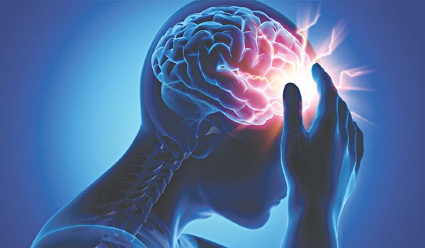 1 dấu hiệu của đột quỵ có thể xảy ra trước đó 90 ngày 1 dấu hiệu của đột quỵ có thể xảy ra trước đó 90 ngày